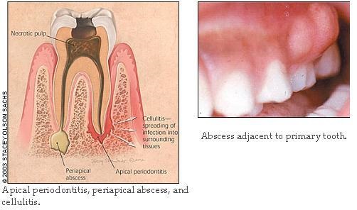 Apical